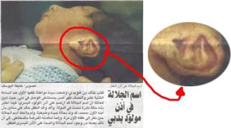 l'enfant  a loreille